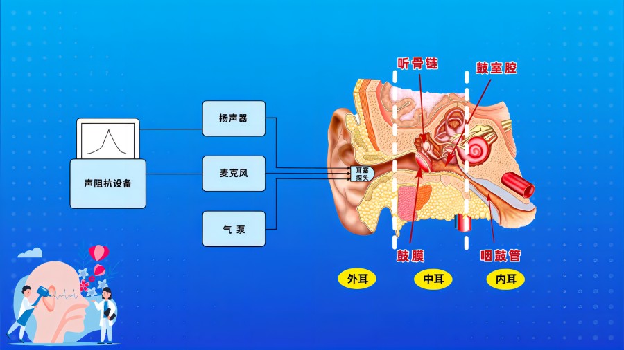 聲導(dǎo)抗檢查